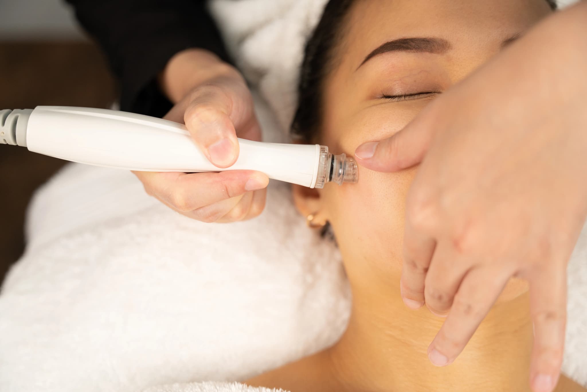 Photo of a Hydropeel session